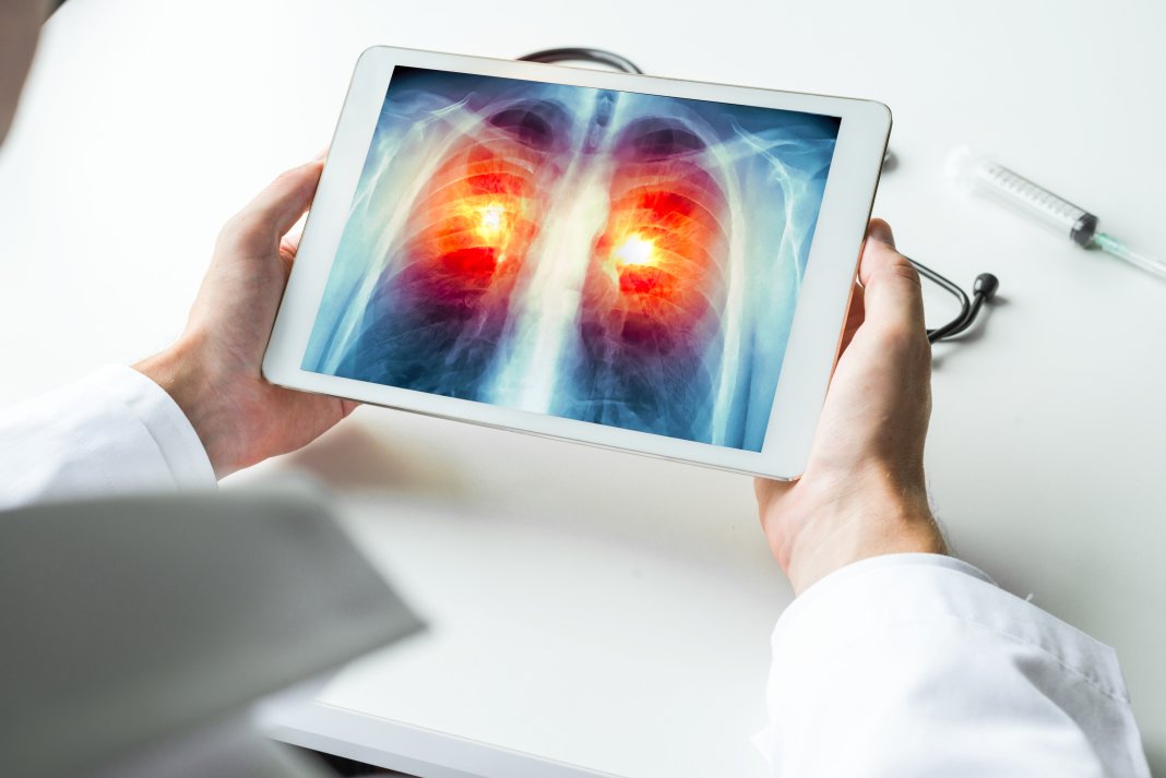 Revoluție în domeniul medical: Modul de funcționare al noului „plămân pe cip”