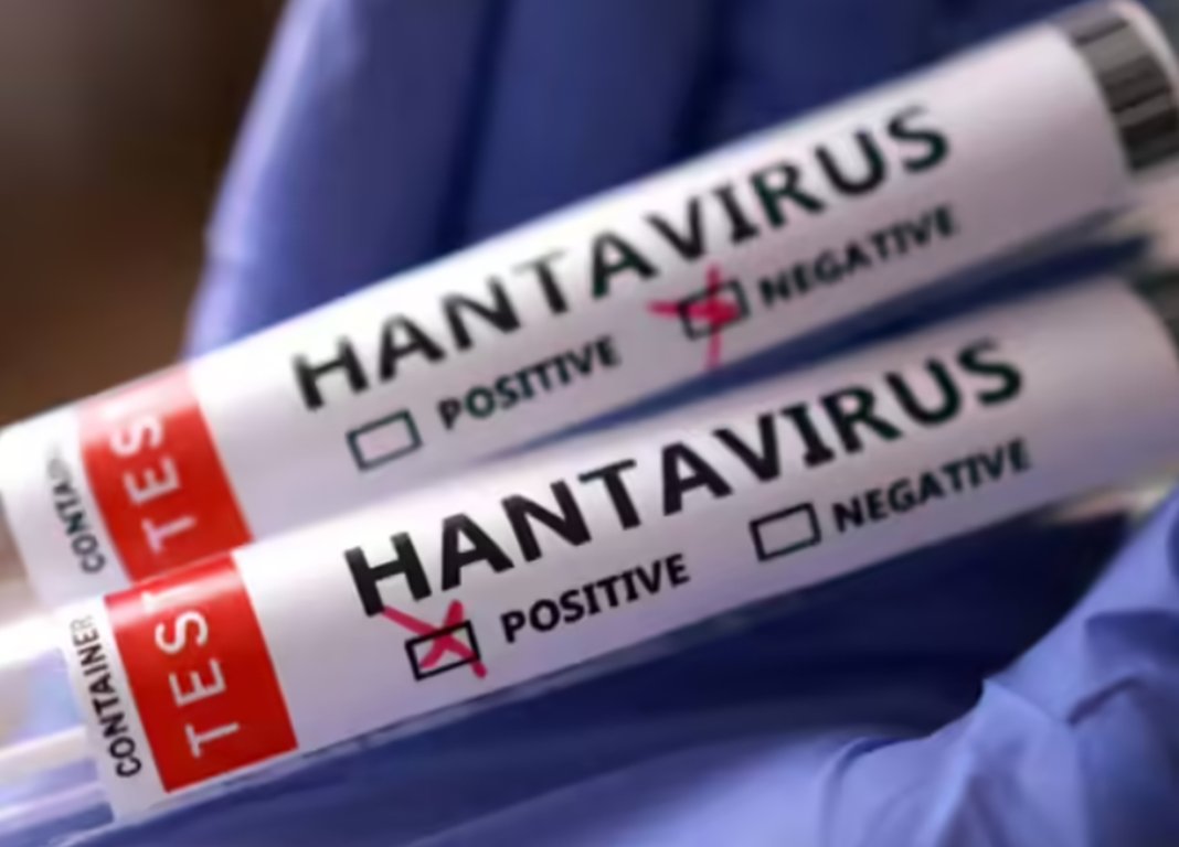 Primul caz de hantavirus în România: pacient spitalizat la Arad, adus din Bihor cu manifestări.