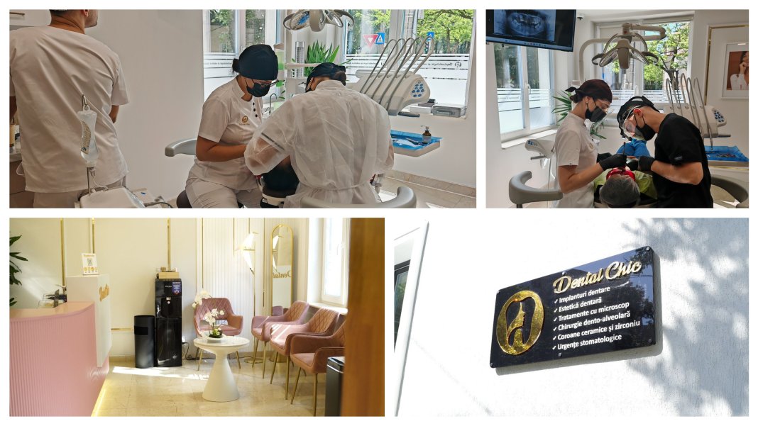 cand-ai-nevoie-de-o-coroana-dentara-i-cat-dureaza-realizarea-ei-ce-presupune-tratamentul-in-cluj-napoca cand-ai-nevoie-de-o-coroana-dentara-i-cat-dureaza-realizarea-ei-ce-presupune-tratamentul-in-cluj-napoca