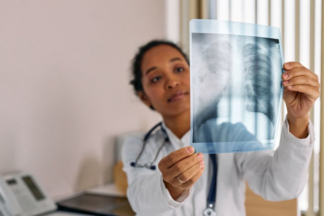 pneumonia